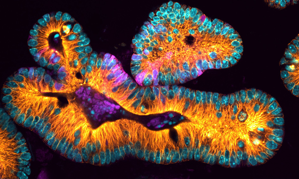 cross-section image of an organoid.