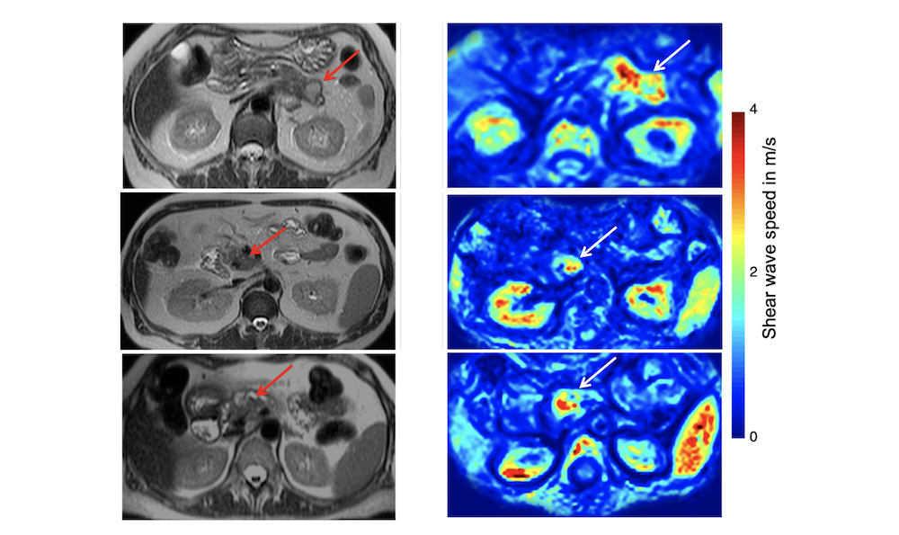 two scans side by side