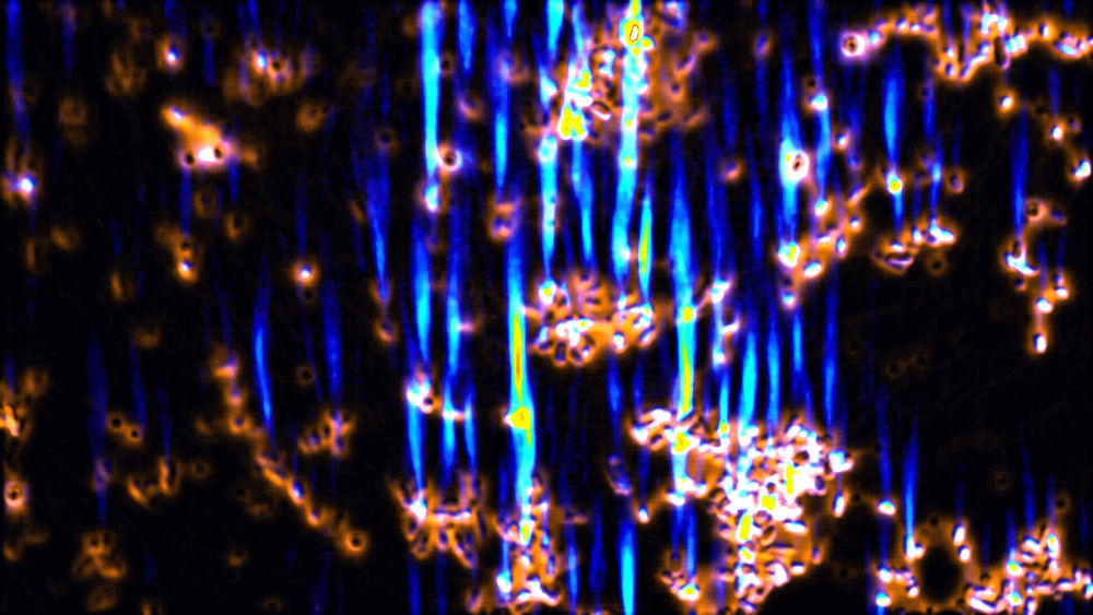 Bioglass-coated bacterial cells imaged with fluorescence microscopy. 