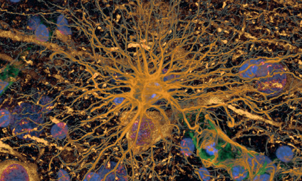 Microscopic image of neurons.
