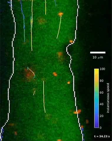 A video shows a perivascular space (area within white lines) into which the researchers injected tiny particles. The particles (shown as moving dots) are trailed by lines which indicate their direction. Having measured the position and velocity of the particles over time, the team then integrated this 2D video with physics-informed neural networks to create an unprecedented high-resolution, 3D look at the brain’s fluid flow system. 