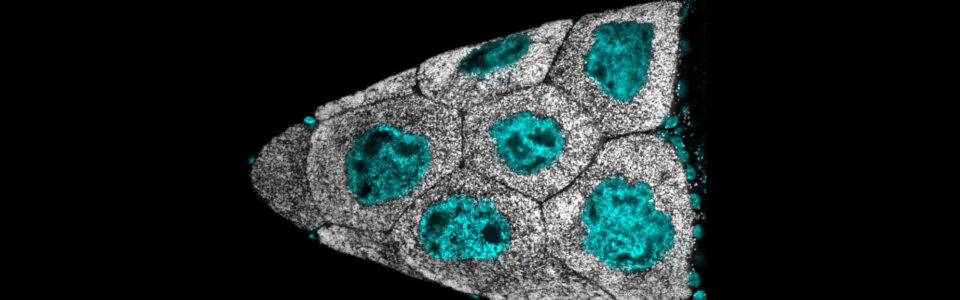 Microscopic image of triangular follicle filled with lipid droplets to illustrate role of lipid droplets in fertility.