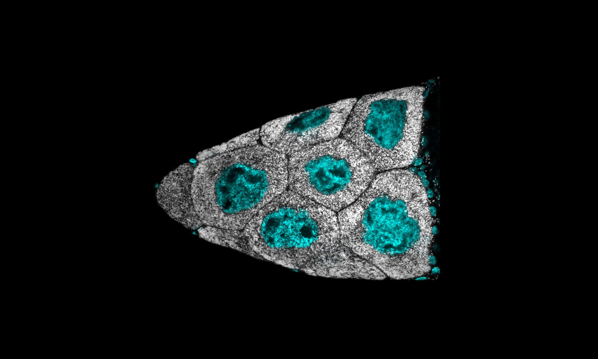 Feature image Microscopic image of triangular follicle filled with lipid droplets to illustrate role of lipid droplets in fertility.