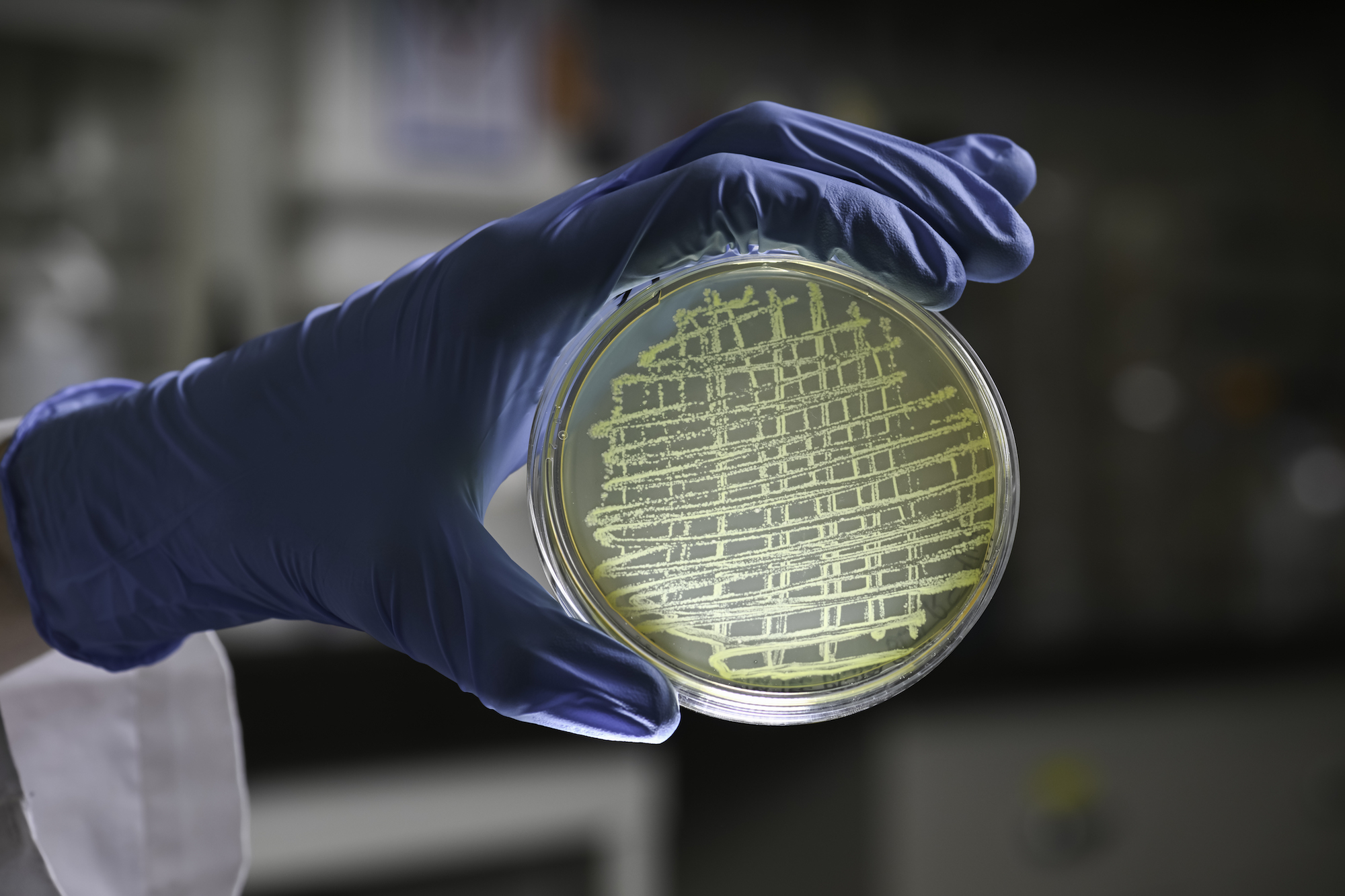 A gloved hand holds a petri dish of bacteria.
