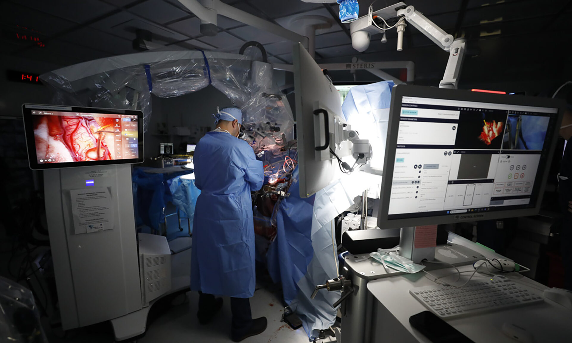 Surgeons performing brain surgery in an operating room with computer screens around them.