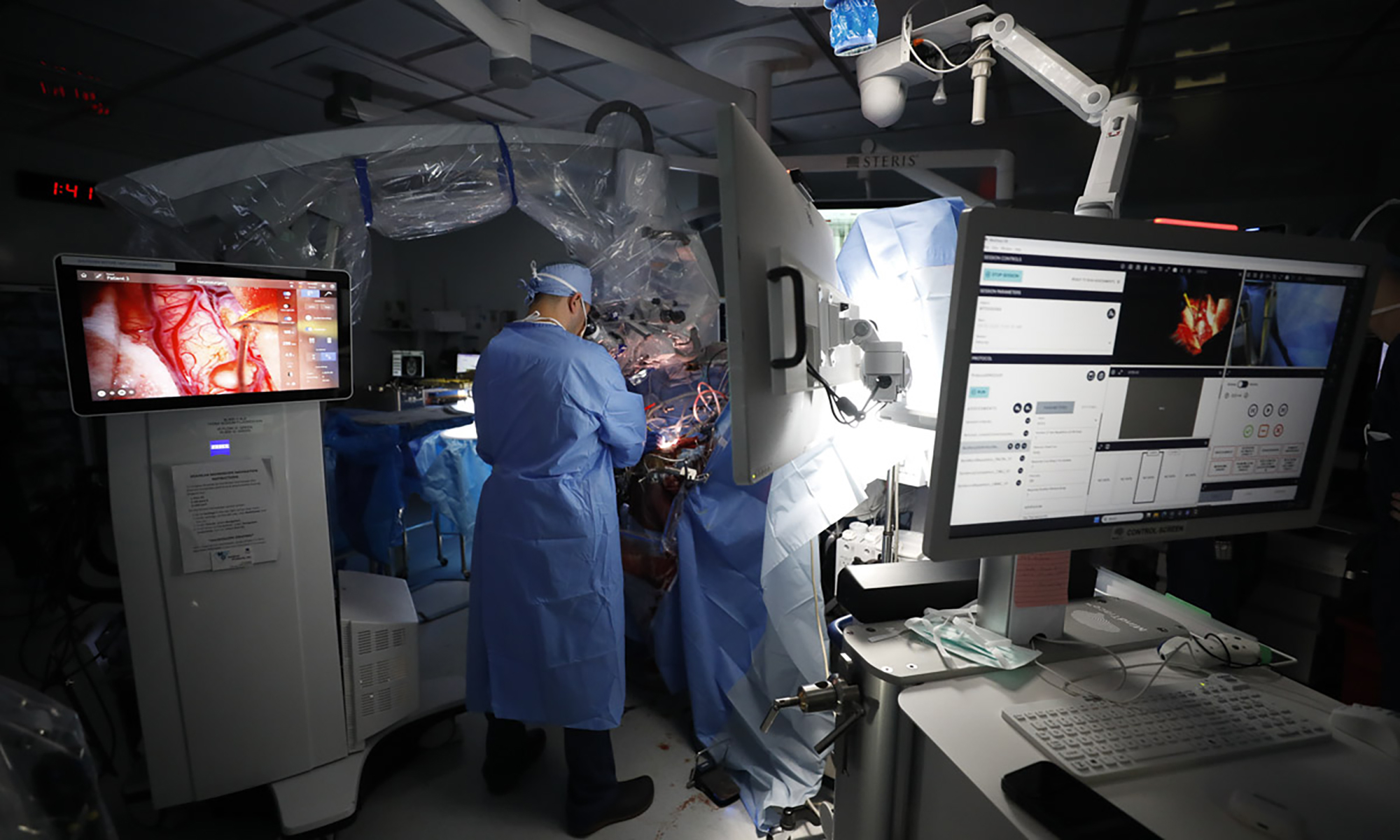 Surgeons performing brain surgery in an operating room with computer screens around them.