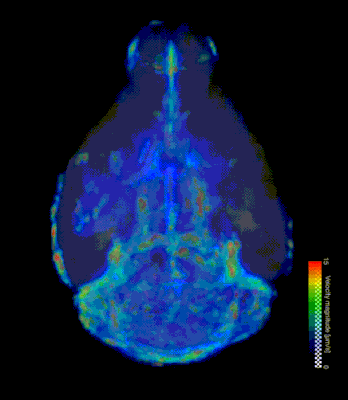 GIF of a 3D visualization showing the flow speed across the brain.