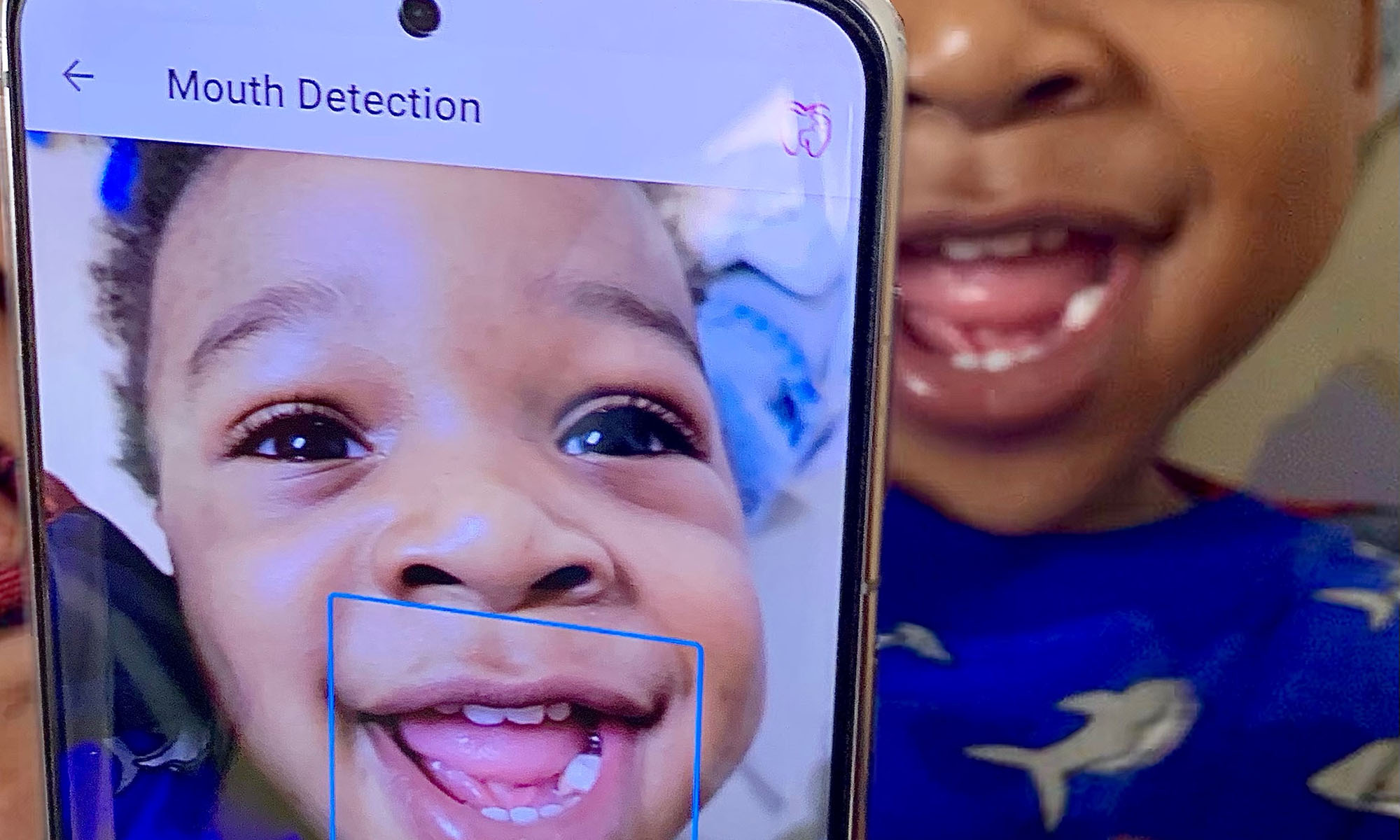 Close-up of a smartphone displaying a open-mouthed smiling child and his teeth with the child himself in the background and slightly off the frame.