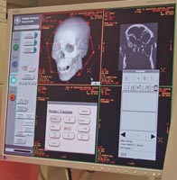 CAT imaging system
