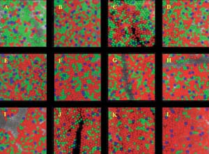 Human retinas