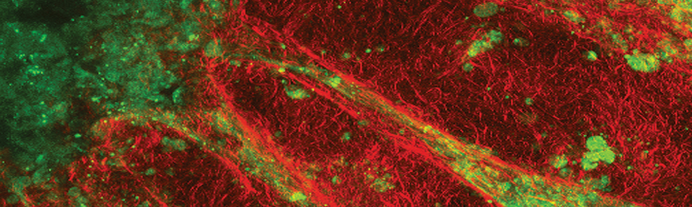 Engineering microvascular networks via acoustic patterning.