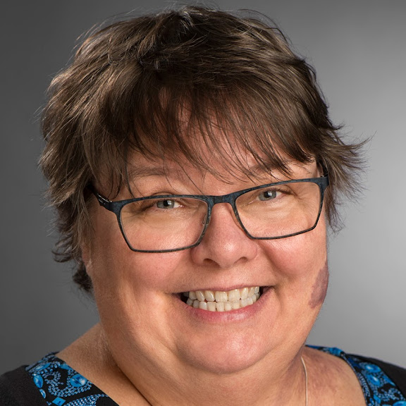 Mary Kitzel