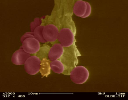An object at a nanoscale.